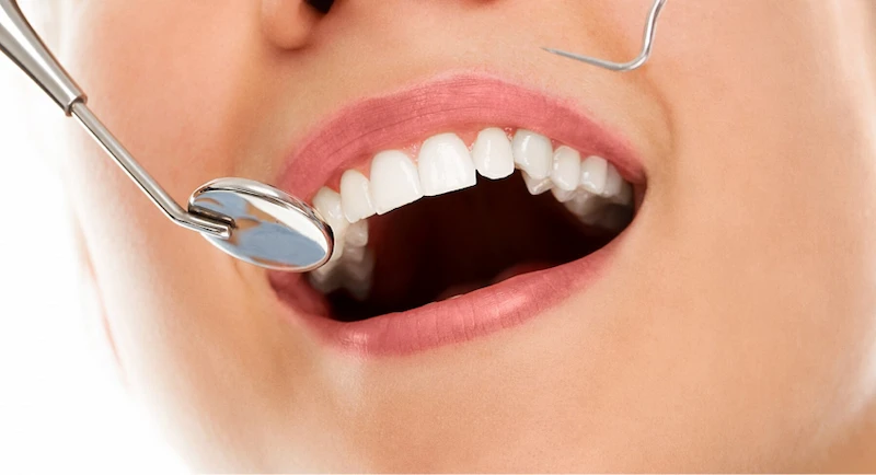 The Role of Dental Health in Boosting Your Overall Wellbeing