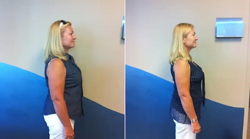 Simple Strategies to Support Sustainable Weight Loss