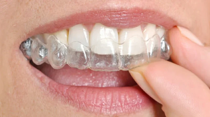 Daily Invisalign Routines That Work for Durham Patients