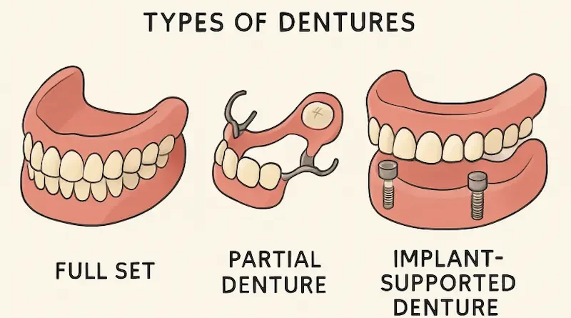 Questions Worth Asking Before Choosing Dentures A Patient’s Guide